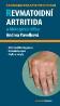 Detail knihyRevmatoidní artritida a biologická léčba