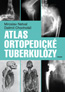 Detail knihyAtlas ortopedické tuberkulózy